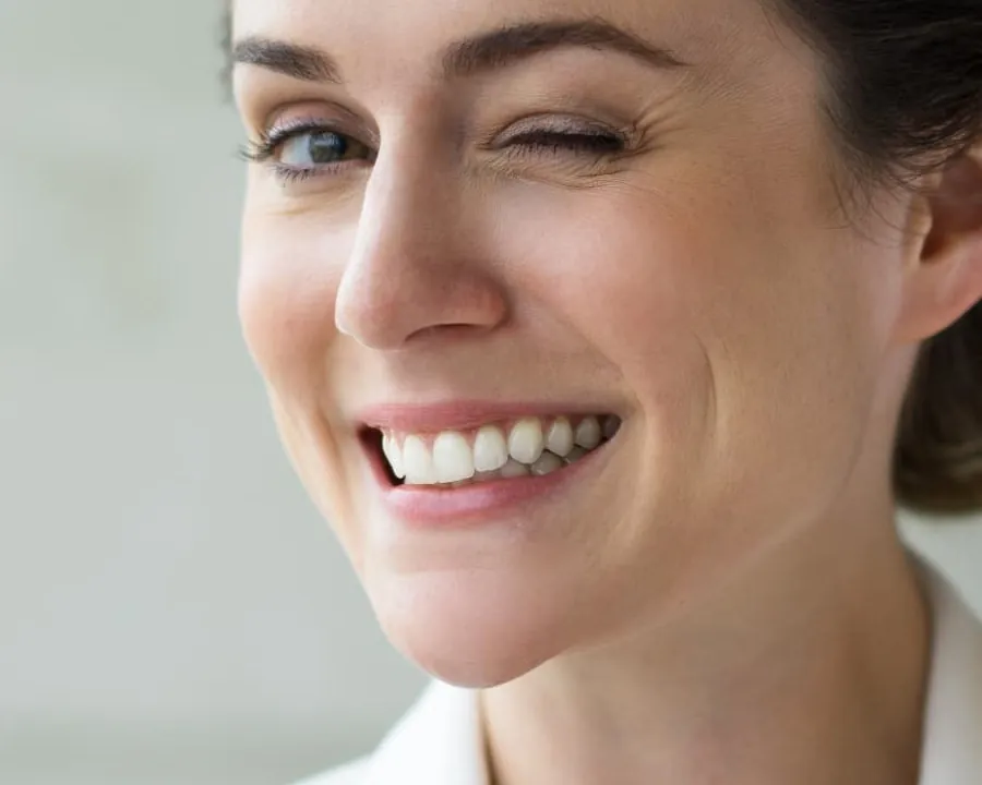 Smile after teeth whitening