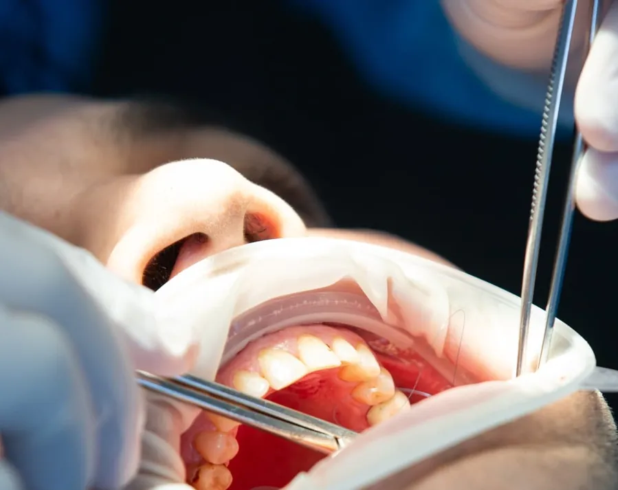 Dentist providing tooth-coloured restorative treatment